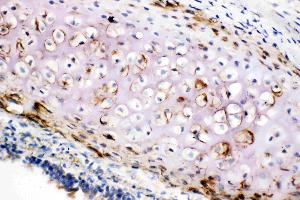 Anti-Collagen II antibody, IHC(F): Rat Trachea Tissue (COL2A1 antibody  (C-Term))