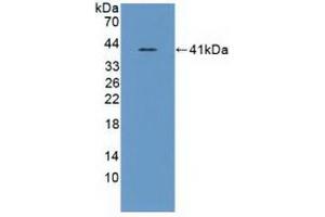 Detection of Recombinant ASNS, Human using Polyclonal Antibody to Asparagine Synthetase (ASNS) (Asparagine Synthetase antibody  (AA 213-536))