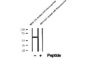 Western blot analysis of extracts of WEHI-231 cells treated with Staurosporine, using Phospho-MST1 (Thr183)/MST2 (Thr180) Antibody.