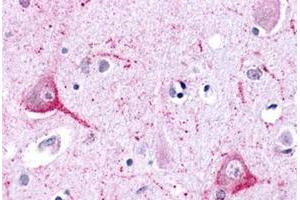 Immunohistochemical staining of human brain, neurons and glia with LPHN2 polyclonal antibody . (LPHN2 antibody  (N-Term))