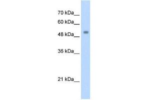 Transfected 293T; WB Suggested Anti-ZSCAN21 Antibody Titration: 1. (ZSCAN21 antibody  (C-Term))