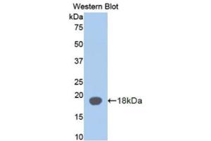 Western Blotting (WB) image for anti-alpha-2-Glycoprotein 1, Zinc-Binding (AZGP1) antibody (Biotin) (ABIN1171671)