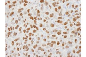 Immunohistochemistry (IHC) image for anti-Histone Deacetylase 1 (HDAC1) (C-Term) antibody (ABIN7448972) (HDAC1 antibody  (C-Term))