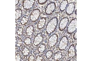 IHC analysis of U1A/SNRPA using anti-U1A/SNRPA antibody (ABIN7600891). (SNRPA1 antibody  (AA 25-218))