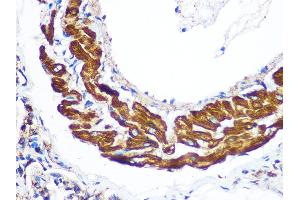 Immunohistochemistry of paraffin-embedded Rat lung using YTHDF2 antibody (ABIN7271427) at dilution of 1:100 (40x lens). (YTHDF2 antibody  (AA 1-200))