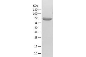 Western Blotting (WB) image for Acyl-CoA Dehydrogenase, Very Long Chain (ACADVL) (AA 41-655) protein (His tag) (ABIN7121680) (ACADVL Protein (AA 41-655) (His tag))