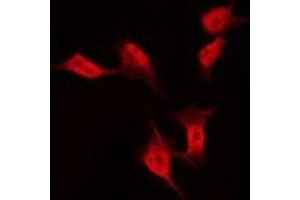 ABIN6275403 staining Hela by IF/ICC. (FAM35A antibody  (Internal Region))