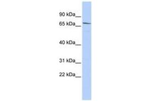 Image no. 1 for anti-Maternal Embryonic Leucine Zipper Kinase (MELK) (AA 432-481) antibody (ABIN6743416) (MELK antibody  (AA 432-481))