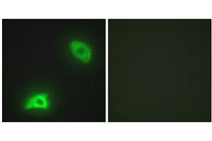 Immunofluorescence analysis of HeLa cells, using DUSP6 antibody. (DUSP6 antibody  (Internal Region))