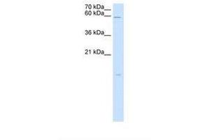 Image no. 2 for anti-Retinoic Acid Receptor Responder (Tazarotene Induced) 3 (RARRES3) (AA 51-100) antibody (ABIN321114)