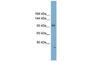 WB Suggested Anti-RC3H2 Antibody Titration:  0. (RC3H2 antibody  (Middle Region))