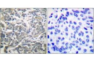 Immunohistochemistry (IHC) image for anti-SNF1A/AMP-Activated Protein Kinase (SNF1A) (AA 140-189) antibody (ABIN2888561) (AMPK alpha antibody  (AA 140-189))