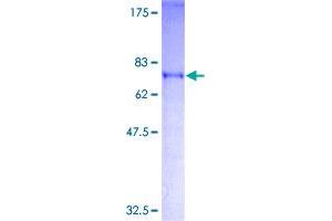 SFRS17A Protein (AA 1-446) (GST tag)