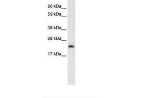 Image no. 1 for anti-High Mobility Group Box 3 (HMGB3) (N-Term) antibody (ABIN202056)
