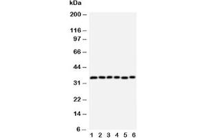 Western blot testing of Aquaporin 4 antibody and Lane 1:  rat heart;  2: rat brain;  3: rat kidney;  4: (h) HT1080;  5: (h) MCF-7;  6: (h) COLO320 cell lysate (Aquaporin 4 antibody  (AA 258-27))