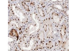 ABIN6267582 at 1/200 staining human kidney tissue sections by IHC-P. (NFKB2 antibody  (pSer866))