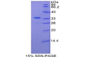 SDS-PAGE (SDS) image for Plexin B1 (PLXNB1) (AA 1780-2042) protein (His tag) (ABIN1877246)