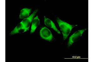 Immunofluorescence of purified MaxPab antibody to ACSL3 on HeLa cell.