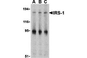 Western Blotting (WB) image for anti-Insulin Receptor Substrate 1 (IRS1) (Middle Region) antibody (ABIN1030966) (IRS1 antibody  (Middle Region))