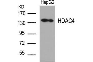 Image no. 2 for anti-Histone Deacetylase 4 (HDAC4) (Ser632) antibody (ABIN197338) (HDAC4 antibody  (Ser632))