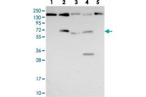 Western blot analysis of Lane 1: RT-4, Lane 2: U-251 MG, Lane 3: Human Plasma, Lane 4: Liver, Lane 5: Tonsil with FAM169A polyclonal antibody  at 1:250-1:500 dilution. (FAM169A antibody)