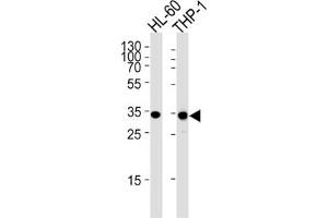 Western Blotting (WB) image for anti-Malate Dehydrogenase 1, NAD (Soluble) (MDH1) antibody (ABIN3001705)