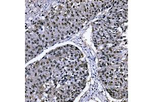IHC analysis of CSNK2B using anti-CSNK2B antibody (ABIN7599092).