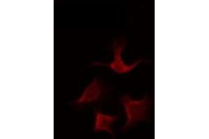 ABIN6275657 staining Hela by IF/ICC. (USP43 antibody  (N-Term))
