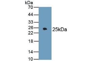 Detection of Recombinant FN, Rat using Monoclonal Antibody to Fibronectin (FN) (Fibronectin antibody  (AA 355-558))