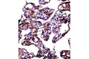 Immunohistochemistry (IHC) image for anti-Fibulin 1 (FBLN1) antibody (ABIN2998151)