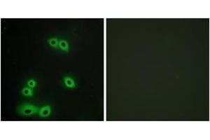 Immunofluorescence analysis of A549 cells, using MUC1 Antibody. (MUC1 antibody  (AA 1191-1240))