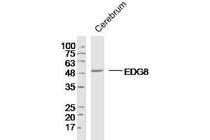 Lane 1: Mouse brain lysates probed with EDG8 Polyclonal Antibody, Unconjugated  at 1:300 overnight at 4˚C. (S1PR5 antibody  (AA 1-200))