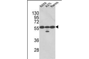 Western blot analysis of PDIA3 Antibody (Center) (ABIN389465 and ABIN2839530) in , , Ramos cell line lysates (35 μg/lane). (PDIA3 antibody  (AA 192-220))