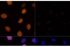 Immunofluorescence analysis of U-2 OS cells using Acetyl-Histone H4-K16 Polyclonal Antibody at dilution of 1:100. (Histone H4 antibody  (acLys16))
