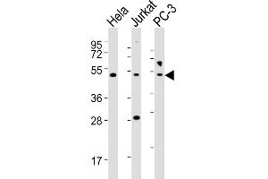 All lanes : Anti-NFKBIE Antibody (Center) at 1:2000 dilution Lane 1: Hela whole cell lysates Lane 2: Jurkat whole cell lysates Lane 3: PC-3 whole cell lysates Lysates/proteins at 20 μg per lane. (NFKBIE antibody  (AA 191-224))