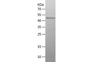 Western Blotting (WB) image for PR Domain Containing 15 (PRDM15) (AA 1282-1507) protein (His-IF2DI Tag) (ABIN7283520) (PRDM15 Protein (AA 1282-1507) (His-IF2DI Tag))