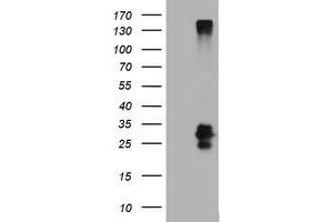 Image no. 2 for anti-CD99 (CD99) antibody (ABIN1497386) (CD99 antibody)