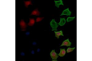 Phospho-FOXO3A (Ser318/Ser321) Antibody staining HepG2 cells(serum starvation treatment) by IF/ICC. (FOXO3 antibody  (pSer318, pSer321))