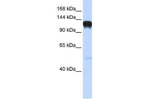 Eph Receptor A5 antibody used at 1 ug/ml to detect target protein. (EPH Receptor A5 antibody  (Middle Region))
