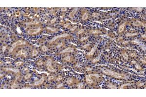 Immunohistochemistry (IHC) image for anti-Nuclear Factor of kappa Light Polypeptide Gene Enhancer in B-Cells Inhibitor, alpha (NFKBIA) (AA 74-247) antibody (ABIN7434194)