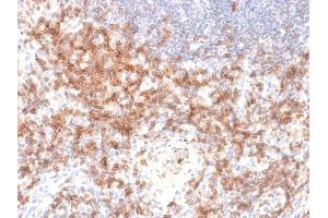 Formalin-fixed, paraffin-embedded human Lymph Node stained with CD27 Rabbit Recombinant Monoclonal Antibody (LPFS2/2034R).