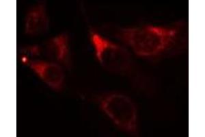 ABIN6275540 staining NIH-3T3 cells by IF/ICC. (TAO Kinase 1 (TAOK1) (Internal Region) antibody)