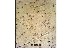 Immunohistochemistry (Paraffin-embedded Sections) (IHC (p)) image for anti-Solute Carrier Family 39 (Zinc Transporter), Member 3 (SLC39A3) (AA 106-134) antibody (ABIN653154)