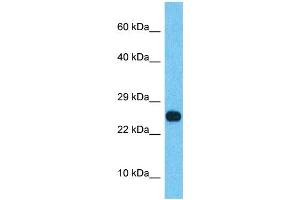 Host:  Rabbit  Target Name:  SSX2B  Sample Type:  Thyroid Tumor lysates  Antibody Dilution:  1. (Synovial Sarcoma, X Breakpoint 2B (SSX2B) (N-Term) antibody)