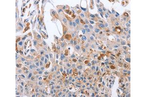 Immunohistochemistry (IHC) image for anti-Neuregulin 4 (NRG4) antibody (ABIN2828341) (Neuregulin 4 antibody)