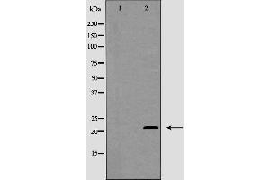 Western blot analysis of MGMT expression in Jurkat cells.