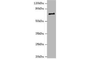 Western blot All lanes: HNRNPM antibody at 2 μg/mL + NIH/3T3 whole cell lysate Secondary Goat polyclonal to rabbit IgG at 1/10000 dilution Predicted band size: 78, 74 kDa Observed band size: 78 kDa (HNRNPM antibody  (AA 491-730))