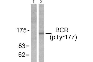Western blot analysis of extracts from K562 cells, using Bcr (phospho-Tyr177) antibody (Line 1 and 2). (BCR antibody  (pTyr177))