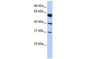 Image no. 1 for anti-LysM, Putative Peptidoglycan-Binding, Domain Containing 4 (LYSMD4) (AA 35-84) antibody (ABIN6741208) (LYSMD4 antibody  (AA 35-84))