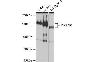 Western blot analysis of extracts of various cell lines, using INCENP antibody (ABIN6130494, ABIN6142441, ABIN6142442 and ABIN6213904) at 1:1000 dilution.